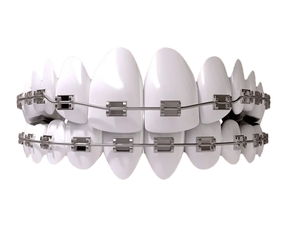 Teeth Filling