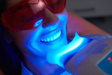 Teeth Filling